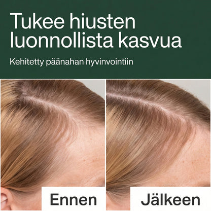 Havus Kasvu Seerumi